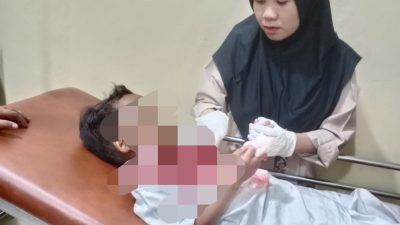 Bocah Laki-laki Usia 8 Tahun Mendapat Perawatan di Rumah Sakit Setelah Lehernya Terjerat Benang Layangan, Kapolsek Serang Baru Berikan Himbauan