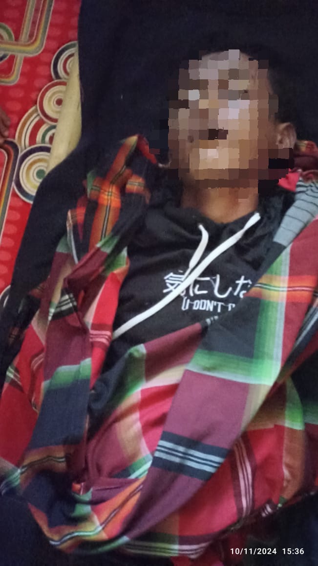 Remaja Tersambar Petir di Bayongbong, Garut