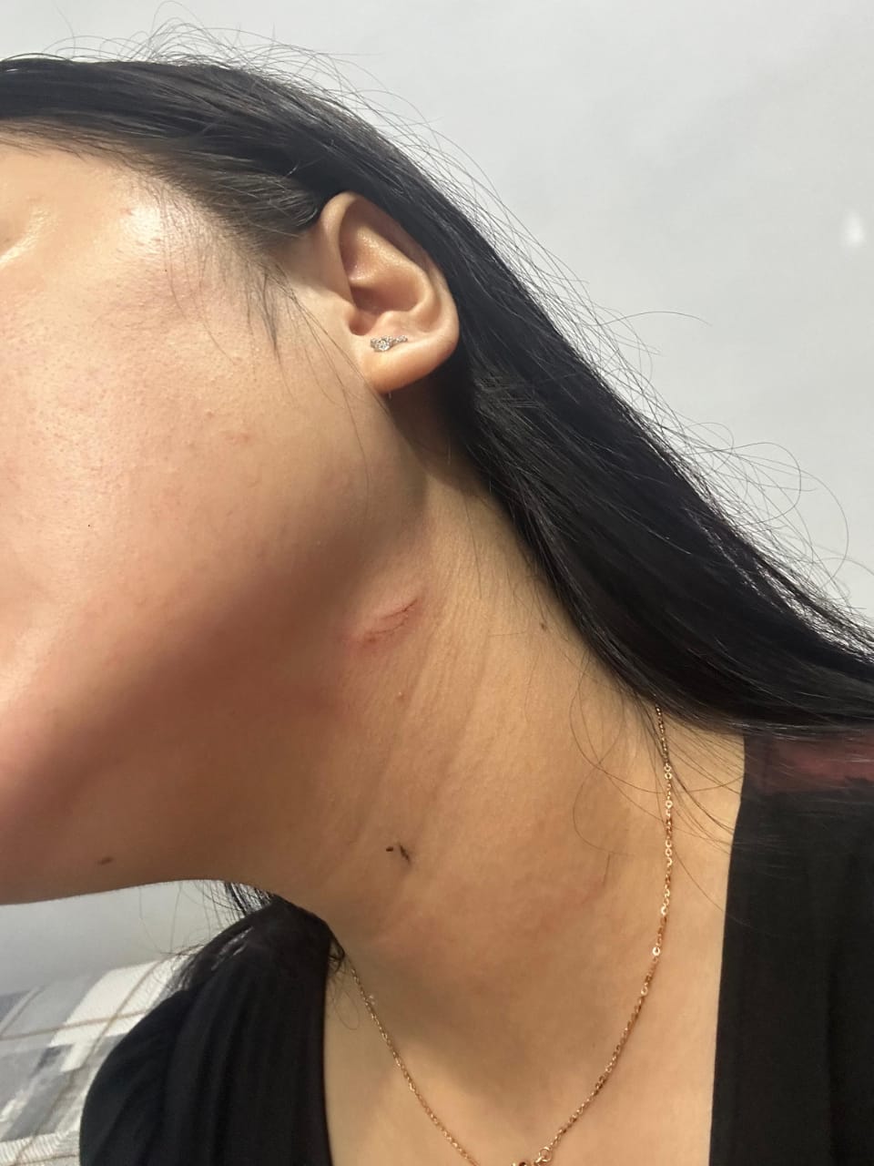 Orang Tua Tiana Wardani Berharap Polres Bogor Tanggapi Laporan Kasus Anaknya Korban Penganiayaan