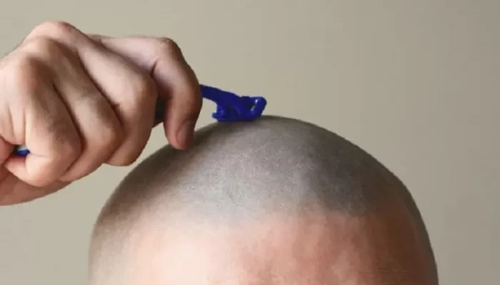 3 Keadaan Mencukur Rambut Dinilai Ibadah