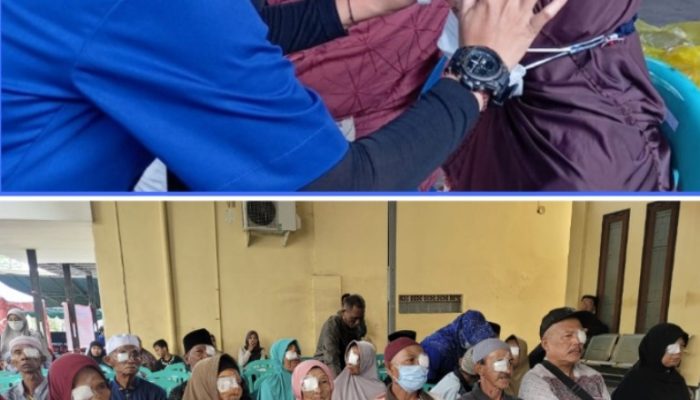 Dokter Buka Perban 183 Pasien, Usai Operasi Katarak