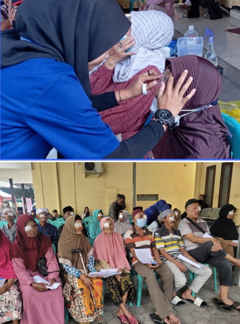Dokter Buka Perban 183 Pasien, Usai Operasi Katarak
