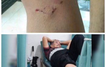 Warga Kecamatan Tanah Abang Resah Dengan Adanya Anjing Gila Yang Mengamuk Di Pemukiman