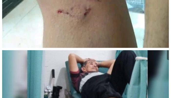 Warga Kecamatan Tanah Abang Resah Dengan Adanya Anjing Gila Yang Mengamuk Di Pemukiman