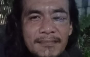 Sadis! Wartawan Dikroyok Saat Liputan Makanan Kedaluwarsa di Bekasi