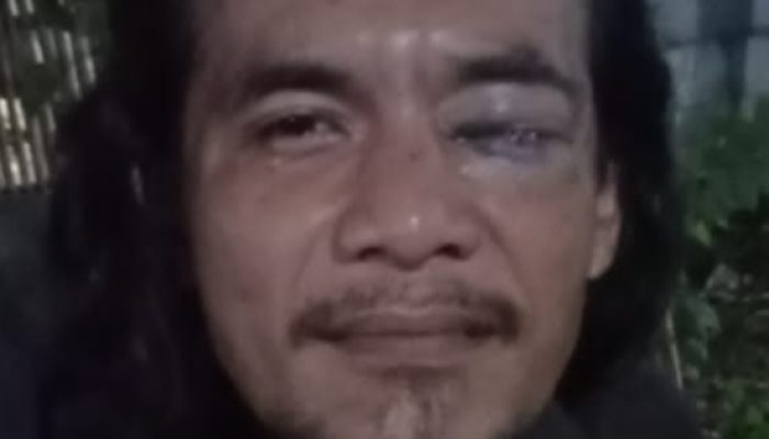 Sadis! Wartawan Dikroyok Saat Liputan Makanan Kedaluwarsa di Bekasi