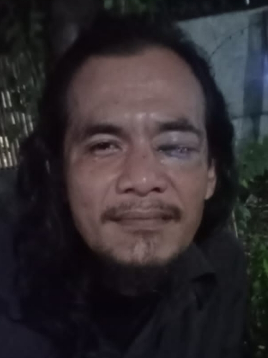 Sadis! Wartawan Dikroyok Saat Liputan Makanan Kedaluwarsa di Bekasi