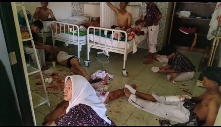 Korban Ledakan SMAN 72 Capai Puluhan Orang Dirawat, Polda Metro Jaya Buka Posko Informasi di Dua RS