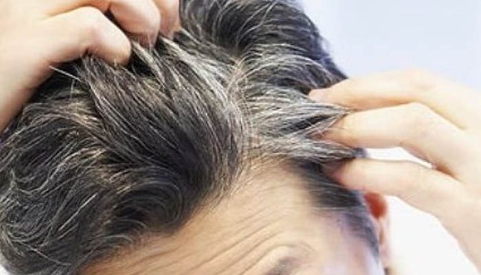 Rambut Memutih atau Tumbuh Uban di Kepala, Ini Maknanya Menurut Sayyid Abdullah al-Haddad