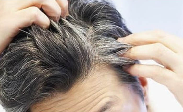 Rambut Memutih atau Tumbuh Uban di Kepala, Ini Maknanya Menurut Sayyid Abdullah al-Haddad