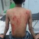 Aksi Brutal Diduga Geng Motor di Gacoan Sinar Logam, Warga Resah Minta Tindakan Tegas