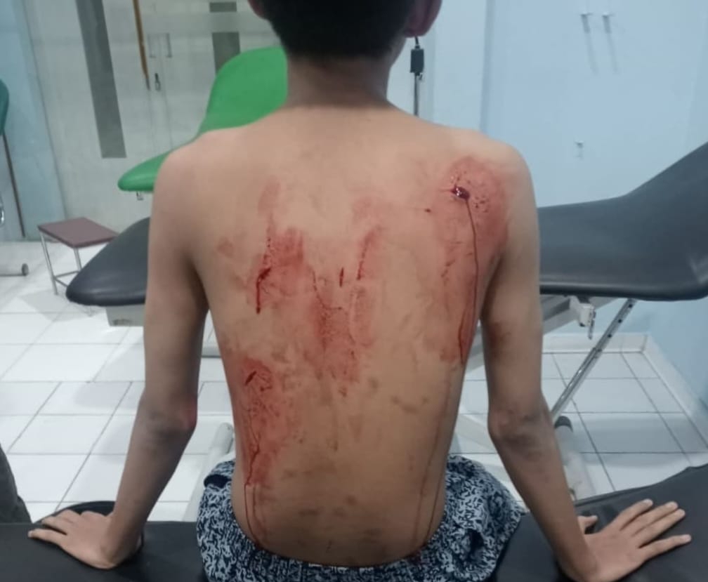 Aksi Brutal Diduga Geng Motor di Gacoan Sinar Logam, Warga Resah Minta Tindakan Tegas