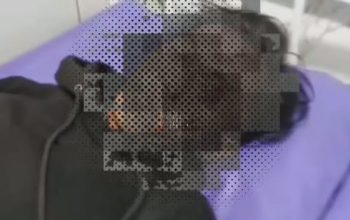 Tragis! Nasib Suami Jemput Istri di Rumah Selingkuhan Malah Dianiaya, Akhirnya Pelaku Dilaporkan Ke Polres Purbalingga