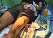 Diduga Menjadi Korban Kekerasan Bersenjata Tajam, Anak Jurnalis di Cirebon Belum Peroleh Kepastian Hukum