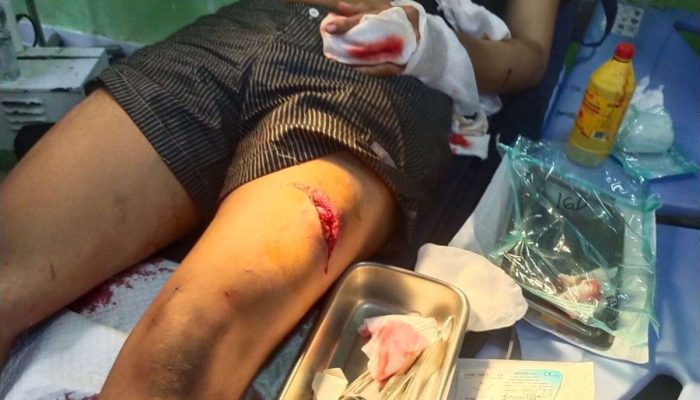 Diduga Menjadi Korban Kekerasan Bersenjata Tajam, Anak Jurnalis di Cirebon Belum Peroleh Kepastian Hukum