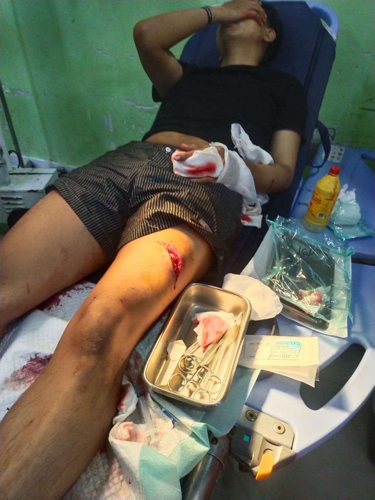 Diduga Menjadi Korban Kekerasan Bersenjata Tajam, Anak Jurnalis di Cirebon Belum Peroleh Kepastian Hukum