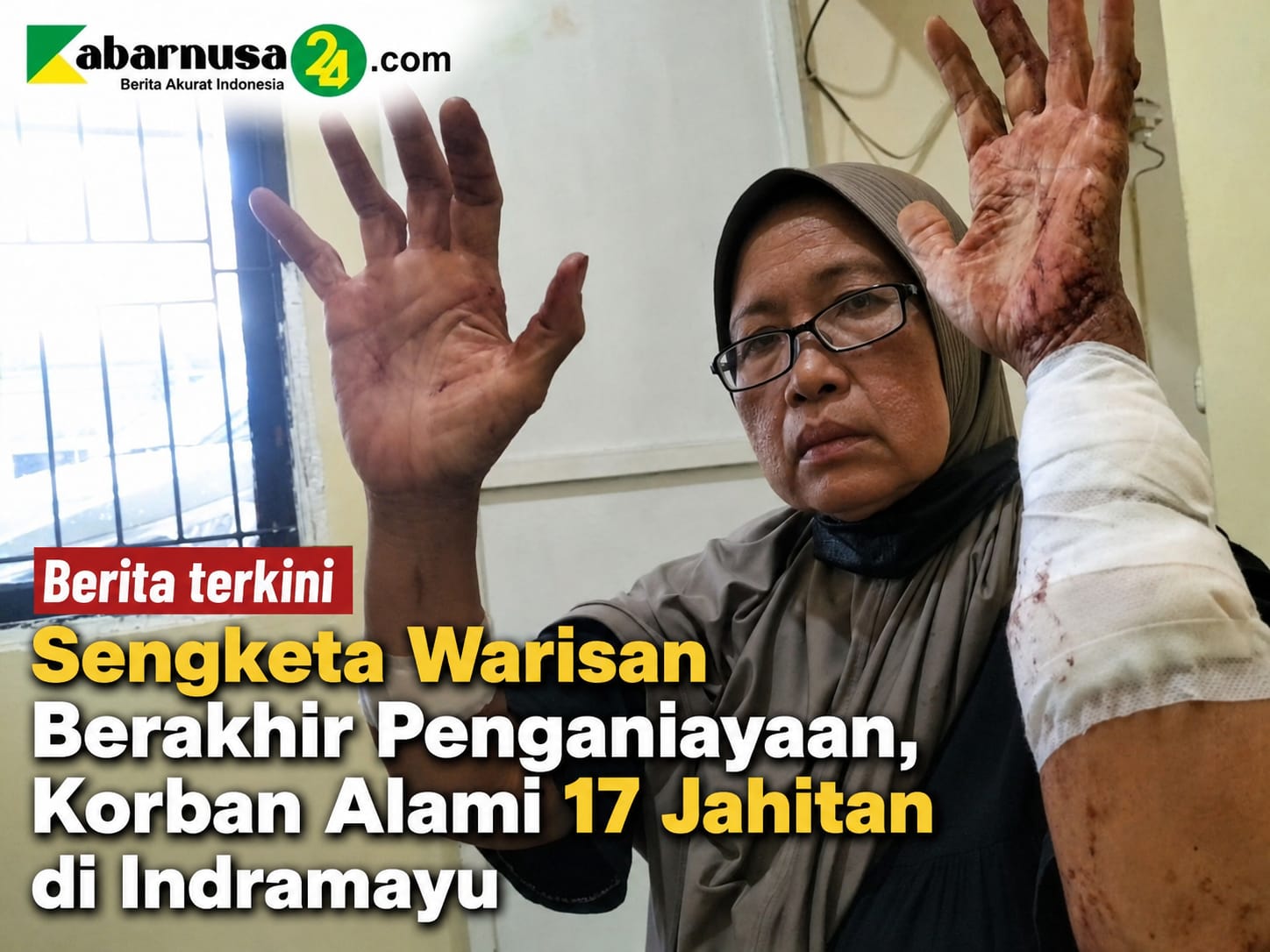 Sengketa Warisan Berakhir Penganiayaan, Korban Alami 17 Jahitan di Indramayu